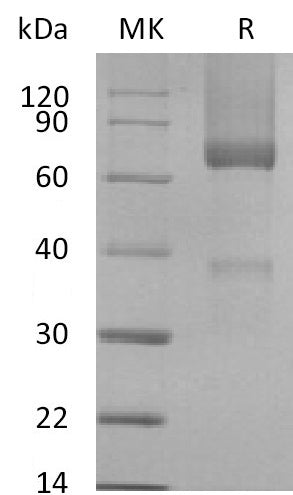 BL-2203NP: Greater than 95% as determined by reducing SDS-PAGE. (QC verified)Recombinant Rhesus Macaque GPC3 Protein (C-6His)