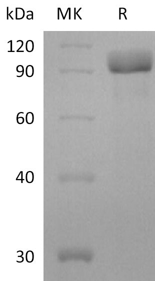 BL-2207NP: Greater than 95% as determined by reducing SDS-PAGE. (QC verified)Recombinant Human HER3 Protein (C-6His)