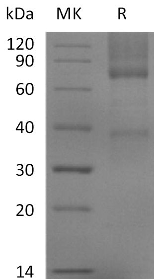BL-2204NP: Greater than 95% as determined by reducing SDS-PAGE. (QC verified)