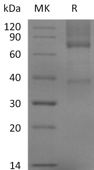 BL-2204NP: Greater than 95% as determined by reducing SDS-PAGE. (QC verified)Recombinant Mouse GPC3 Protein (C-6His)