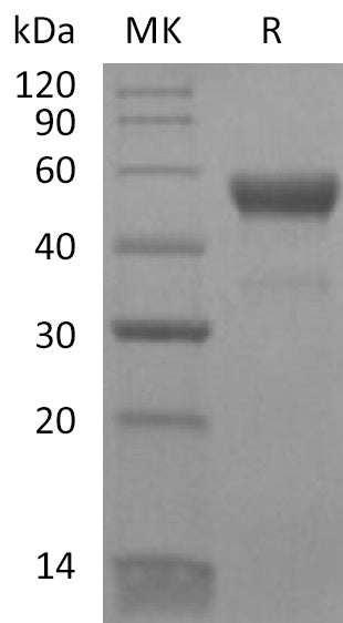 BL-2161NP: Greater than 95% as determined by reducing SDS-PAGE. (QC verified)Recombinant Human CD300LB Protein (C-Fc)