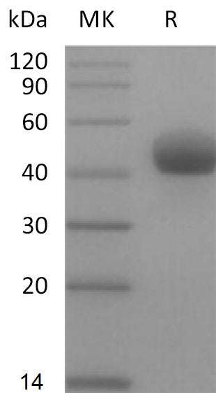 BL-2209NP: Greater than 95% as determined by reducing SDS-PAGE. (QC verified)Recombinant Human TGFBR1Protein (C-Fc)