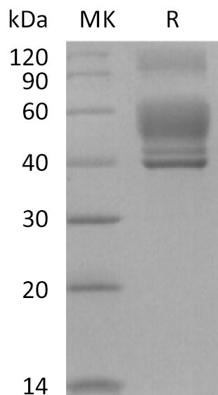 BL-2093NP: Greater than 95% as determined by reducing SDS-PAGE. (QC verified)Recombinant Human IL-13 Protein (C-Fc)