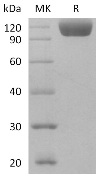 BL-2141NP: Greater than 95% as determined by reducing SDS-PAGE. (QC verified)Recombinant Human Siglec-10 Protein (C-Fc)