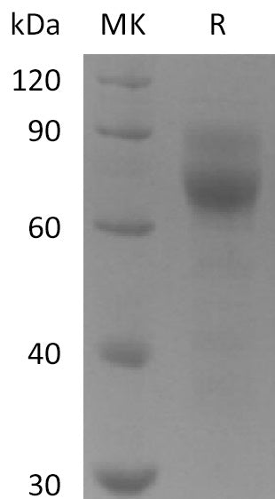 BL-2218NP: Greater than 95% as determined by reducing SDS-PAGE. (QC verified)Recombinant Human AXL Protein (C-6His)
