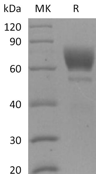 BL-2222NP: Greater than 95% as determined by reducing SDS-PAGE. (QC verified)Recombinant Mouse AXL Protein (C-6His)