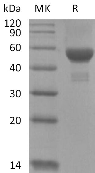 BL-2229NP: Greater than 95% as determined by reducing SDS-PAGE. (QC verified)Recombinant Human Carbonic Anhydrase 9 Protein (C-6His)