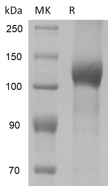 BL-2230NP: Greater than 90% as determined by reducing SDS-PAGE. (QC verified)Recombinant Mouse LEPR Protein (C-10His)