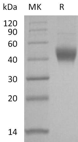 BL-2095NP: Greater than 95% as determined by reducing SDS-PAGE. (QC verified)Recombinant Human IL-7RA Protein (C-6His)