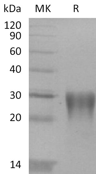 BL-2234NP: Greater than 95% as determined by reducing SDS-PAGE. (QC verified)Recombinant Human LAP Protein (TGF-beta 1)