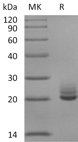 BL-2880NP: Greater than 95% as determined by reducing SDS-PAGE. (QC verified)Recombinant Mouse FGF-21 Protein (C-6His)