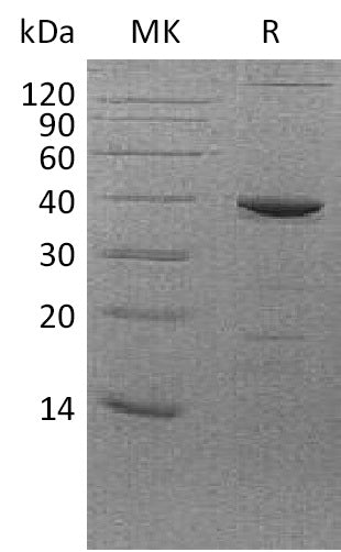 BL-1257NP: Greater than 95% as determined by reducing SDS-PAGE. (QC verified)