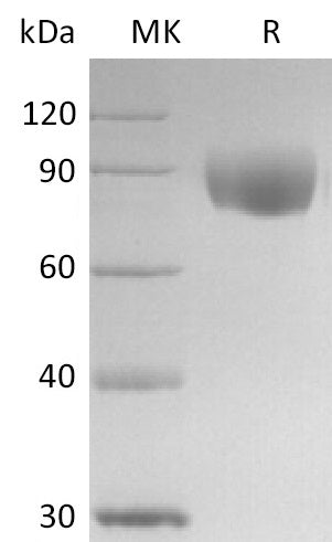 BL-2746NP: Greater than 95% as determined by reducing SDS-PAGE. (QC verified)Recombinant Human IL-17RD Protein (C-Fc)