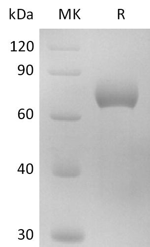BL-2737NP: Greater than 95% as determined by reducing SDS-PAGE. (QC verified)Recombinant Human IL-17RB Protein (C-Fc)