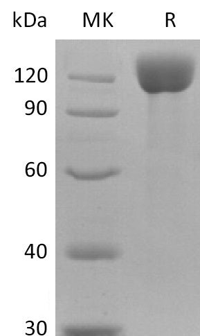 BL-2530NP: Greater than 95% as determined by reducing SDS-PAGE. (QC verified)Recombinant Human APN Protein (C-6His)