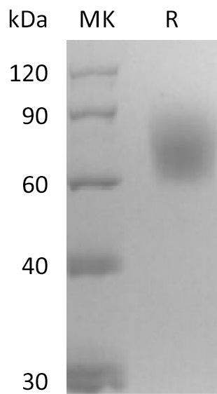 BL-2590NP: Greater than 95% as determined by reducing SDS-PAGE. (QC verified)Recombinant Mouse TrkB Protein (C-6His)