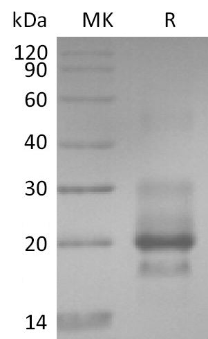 BL-2723NP: Greater than 95% as determined by reducing SDS-PAGE. (QC verified)Recombinant Human TRAIL R1 Protein (C-6Hisï¼‰