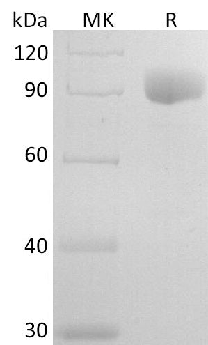 BL-2725NP: Greater than 95% as determined by reducing SDS-PAGE. (QC verified)Recombinant Human IL-6RA Protein (C-Fc)