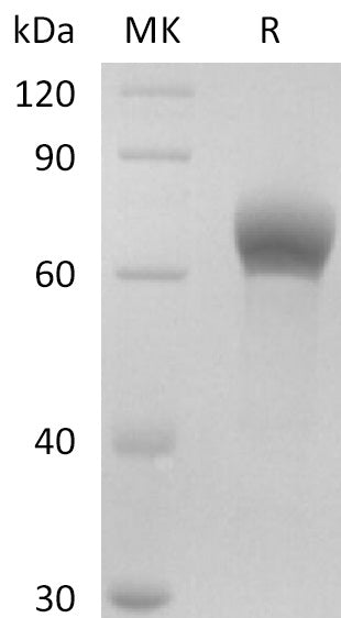 BL-2749NP: Greater than 95% as determined by reducing SDS-PAGE. (QC verified)Recombinant Human DKK-1 Protein (C-Fc)