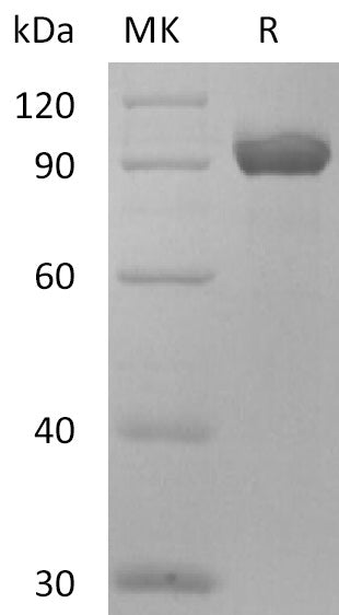 BL-2743NP: Greater than 95% as determined by reducing SDS-PAGE. (QC verified)Recombinant Human NPR3 Protein (C-Fc)