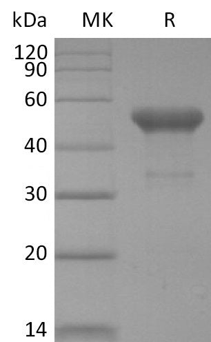 BL-2521NP: Greater than 95% as determined by reducing SDS-PAGE. (QC verified)Recombinant Human PVRIG Protein (C-Fc)