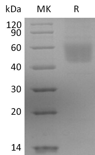 BL-2513NP: Greater than 95% as determined by reducing SDS-PAGE. (QC verified)Recombinant Human IL-3RA Protein (C-6His)