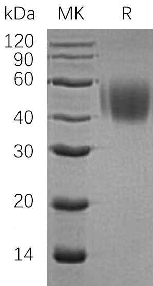 BL-0394NP: Greater than 95% as determined by reducing SDS-PAGE. (QC verified)Recombinant Human SLAMF1 Protein (C-6His)