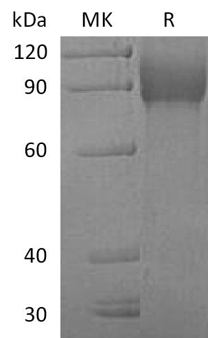 BL-0392NP: Greater than 95% as determined by reducing SDS-PAGE. (QC verified)Recombinant Human VCAM-1 Protein (C-6His)