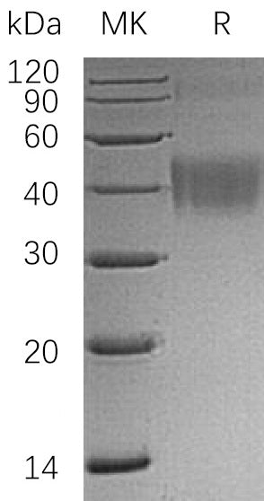 BL-0396NP: Greater than 95% as determined by reducing SDS-PAGE. (QC verified)Recombinant Human CD200 Protein (C-6His)