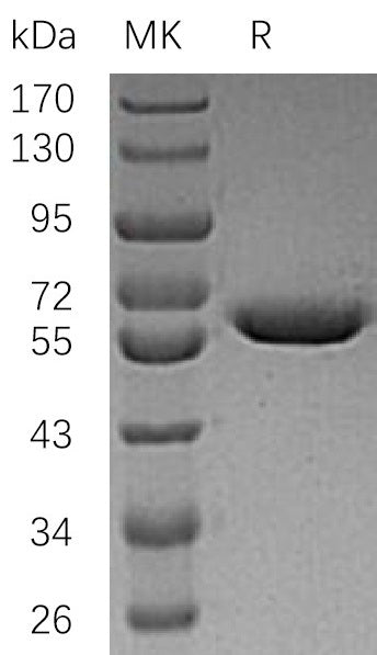 BL-1315NP: Greater than 95% as determined by reducing SDS-PAGE. (QC verified)Recombinant Human ARSA Protein (C-6His)