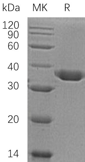 BL-0390NP: Greater than 95% as determined by reducing SDS-PAGE. (QC verified)Recombinant Human Carbonic Anhydrase 10 Protein (C-6His)