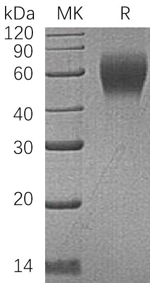 BL-0397NP: Greater than 95% as determined by reducing SDS-PAGE. (QC verified)Recombinant Human CD200 R1 Protein (C-6His)