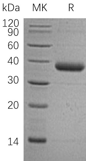 BL-2587NP: Greater than 95% as determined by reducing SDS-PAGE. (QC verified)Recombinant Human C1QTNF1 Protein (C-6His)