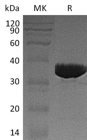 BL-1311NP: Greater than 95% as determined by reducing SDS-PAGE. (QC verified)Recombinant Human GALM Protein (C-6His)