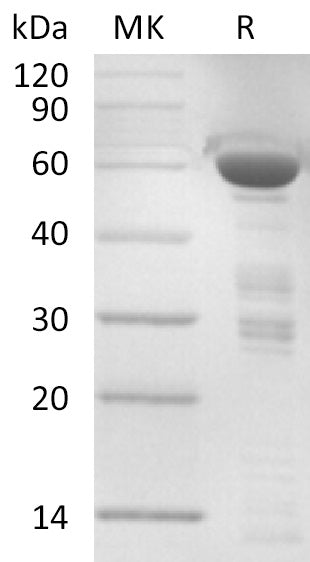 BL-0251NP: Greater than 81% as determined by reducing SDS-PAGE. (QC verified)