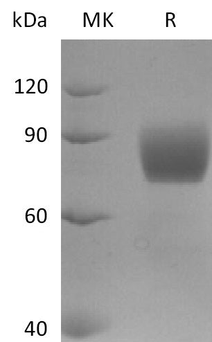 BL-2552NP: Greater than 95% as determined by reducing SDS-PAGE. (QC verified)Recombinant Human FGFR2IIIb Protein (C-Fc)