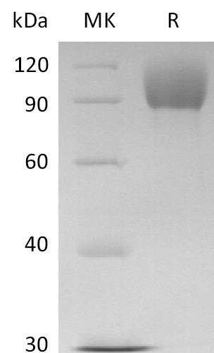 BL-2608NP: Greater than 95% as determined by reducing SDS-PAGE. (QC verified)Recombinant Human FGFR2IIIb Protein (357AA,C-Fc)