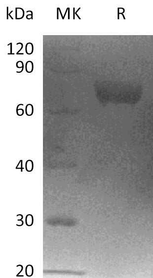 BL-2810NP: Greater than 95% as determined by reducing SDS-PAGE. (QC verified)Recombinant Human LRRC15 Protein (C-6His)