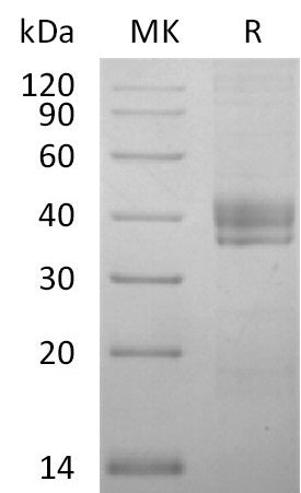 BL-2741NP: Greater than 95% as determined by reducing SDS-PAGE. (QC verified)Recombinant Human CTGF Protein (C-6His)