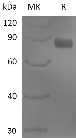 BL-2811NP: Greater than 95% as determined by reducing SDS-PAGE. (QC verified)Recombinant Human NTNG1 Protein (C-Fc)