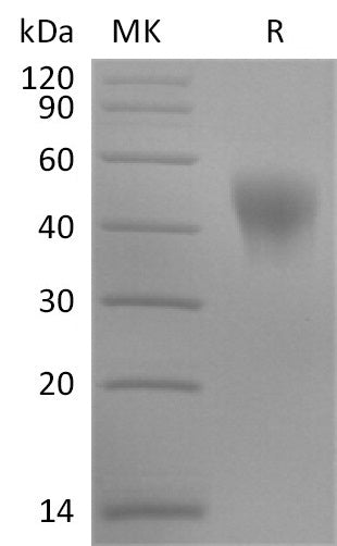 BL-2819NP: Greater than 95% as determined by reducing SDS-PAGE. (QC verified)Recombinant Human KIR2DL1 Protein (C-6His)