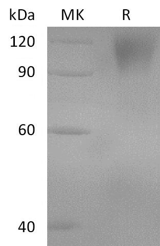 BL-2712NP: Greater than 95% as determined by reducing SDS-PAGE. (QC verified)Recombinant Human GUCY2C Protein (C-Fc)