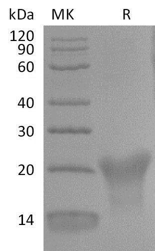 BL-2818NP: Greater than 95% as determined by reducing SDS-PAGE. (QC verified)Recombinant Human BAFFR Protein (C-6His)