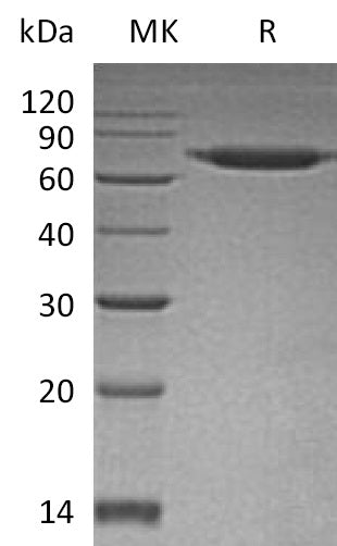 BL-1268NP: Greater than 95% as determined by reducing SDS-PAGE. (QC verified)Recombinant Human SENP8 Protein (N-6His)