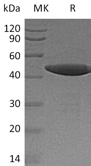 BL-1267NP: Greater than 95% as determined by reducing SDS-PAGE. (QC verified)Recombinant Human SENP7 Protein
