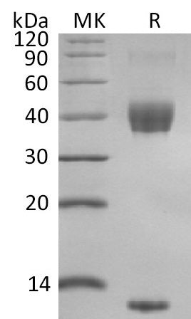 BL-2611NP: Greater than 95% as determined by reducing SDS-PAGE. (QC verified)Recombinant Mouse Latent TGF-beta 1 Protein (N-8His)