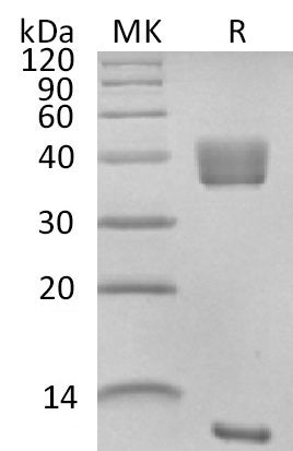 BL-2627NP: Greater than 95% as determined by reducing SDS-PAGE. (QC verified)Recombinant Rhesus Macaque Latent TGF-beta 1 Protein (N-6His)