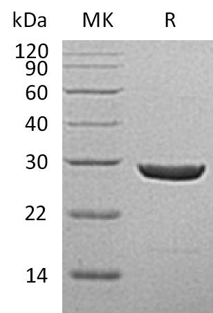 BL-1271NP: Greater than 95% as determined by reducing SDS-PAGE. (QC verified)Recombinant Human UCH-L1 Protein (C-6His)