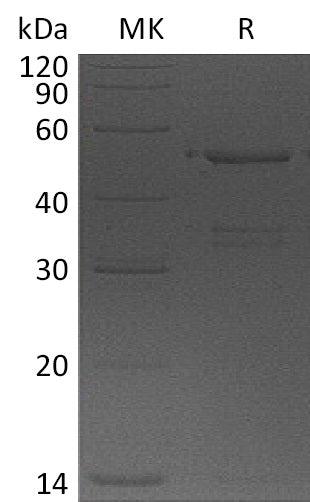 BL-1273NP: Greater than 85% as determined by reducing SDS-PAGE. (QC verified)Recombinant Human USP14 Protein (N-6His)