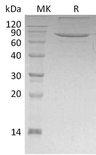BL-1274NP: Greater than 85% as determined by reducing SDS-PAGE. (QC verified)Recombinant Human XPNPEP1 Protein (C-6His)